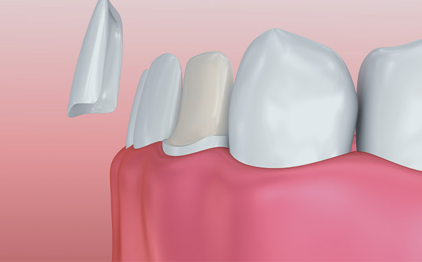 Treatment - Charlbury Dental Practice