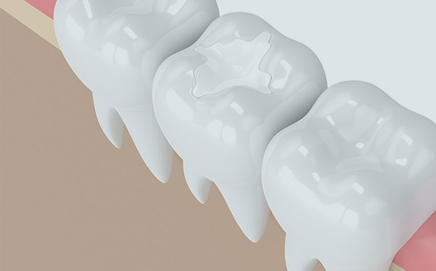 Treatment - Charlbury Dental Practice