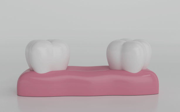 Treatment - Charlbury Dental Practice